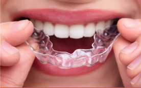 이물감이 거의 없다