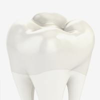 크라운-지르코니아